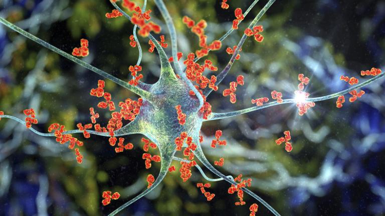 Recognizing GBS - Signs and Possible Treatment